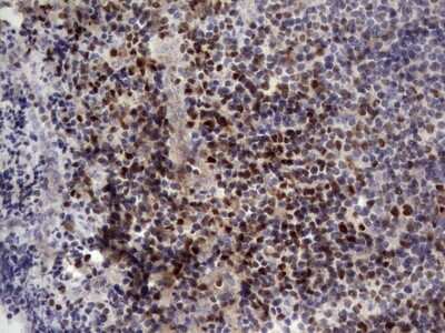 Immunohistochemistry: Aiolos/IKZF3 Antibody (7E11) [NBP2-46048] - Analysis of Human tonsil tissue. (Heat-induced epitope retrieval by 1 mM EDTA in 10mM Tris, pH8.5, 120C for 3min)