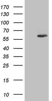 Western Blot: Aiolos/IKZF3 Antibody (7E11) [NBP2-46048] - Analysis of HEK293T cells were transfected with the pCMV6-ENTRY control (Left lane) or pCMV6-ENTRY IKZF3.