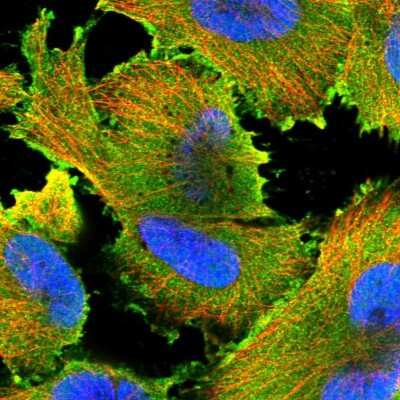 Immunocytochemistry/Immunofluorescence: Aiolos/IKZF3 Antibody [NBP1-89185] - Staining of human cell line U-251 MG shows localization to plasma membrane and cytosol. Antibody staining is shown in green.