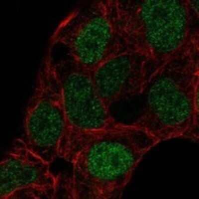 Immunocytochemistry/Immunofluorescence: Aiolos/IKZF3 Antibody [NBP3-16978] - Staining of human cell line RT4 shows localization to nucleoplasm.