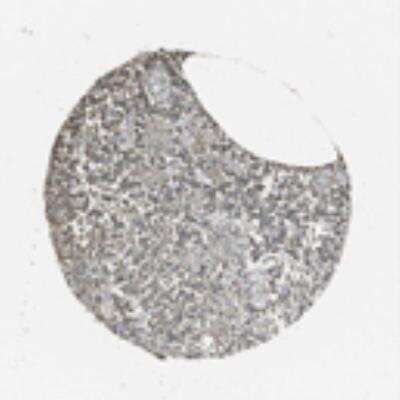 Immunohistochemistry: Aiolos/IKZF3 Antibody [23220002] - Normal tissues showed weak to moderate nuclear and cytoplasmic staining. Testis, trophoblasts, neuronal cells of cerebral cortex and follicle cells of tonsil displayed strong staining. Malignant tissues displayed a similar staining pattern as normal tissues. Testicular and stomach cancers mainly showed cytoplasmic staining.  Image and statement courtesy of the Human Protein Atlas (HPA).  View all of the IHC expression profiles performed by the Human Protein Atlas.