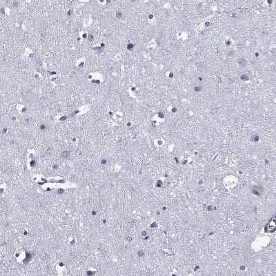 Immunohistochemistry-Paraffin: Aiolos/IKZF3 Antibody [NBP3-16978] - Staining of human cerebral cortex shows low expression as expected.