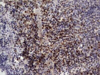 Immunohistochemistry: Aiolos/IKZF3 Antibody (OTI7E11) - Azide and BSA Free [NBP2-71698] - Analysis of Human tonsil tissue. (Heat-induced epitope retrieval by 1 mM EDTA in 10mM Tris, pH8.5, 120C for 3min)