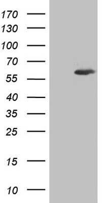 Western Blot: Aiolos/IKZF3 Antibody (OTI7E11) - Azide and BSA Free [NBP2-71698] - Analysis of HEK293T cells were transfected with the pCMV6-ENTRY control (Left lane) or pCMV6-ENTRY IKZF3.