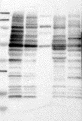 Western Blot: Aiolos/IKZF3 Antibody [23220002] - Samples:  Lane 1, Marker [kDa]: 250, 130, 95, 72, 55, 36, 28, 17, 11  Lane 2, RT-4  Lane 3, U-251MG sp  Lane 4, Human Plasma  Lane 5, Liver  Lane 6, Tonsil , Target weight [kDa]:  58, 54, 53, 52, 49, 48, 47, 43, 42, 37, 33 (splice variants)   Validation score:   2   Validation description:  Supportive - Band of predicted size in kDa (+/-20%) with additional bands present.