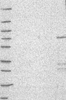 Western Blot: Aiolos/IKZF3 Antibody [NBP3-16978] - Lane 1: Marker [kDa] 250, 130, 95, 72, 55, 36, 28, 17, 10;   Lane 2: RT4;   Lane 3: U-251 MG