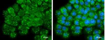 Immunocytochemistry/Immunofluorescence: Airway Trypsin-like Protease/HAT/TMPRSS11D Antibody [NBP2-20668] - : A431 cells were fixed in 4% paraformaldehyde at RT for 15 min. Green: TMPRSS11D protein stained by TMPRSS11D antibody diluted at 1:500. Blue: Hoechst 33342 staining. Scale bar = 10 um.