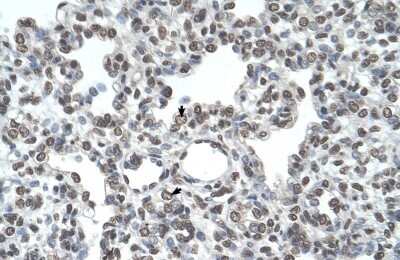 Immunohistochemistry-Paraffin: Airway Trypsin-like Protease/HAT/TMPRSS11D Antibody [NBP1-62545] - Human Lung Alveolar cells (indicated with arrows), 4-8ug/ml.