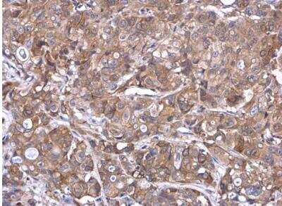 Immunohistochemistry-Paraffin: Airway Trypsin-like Protease/HAT/TMPRSS11D Antibody [NBP2-20668] -  Paraffin-embedded MCF7 xenograft.  TMPRSS11D antibody diluted at 1:500.