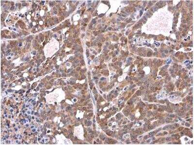 Immunohistochemistry-Paraffin: Airway Trypsin-like Protease/HAT/TMPRSS11D Antibody [NBP2-20668] - Paraffin-embedded NCl-H1299 xenograft. TMPRSS11D antibody diluted at 1:500.