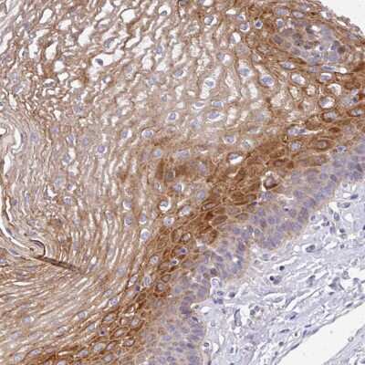 Immunohistochemistry-Paraffin: Airway Trypsin-like Protease/HAT/TMPRSS11D Antibody [NBP2-49065] - Staining of human esophagus shows moderate positivity in squamous epithelial cells.