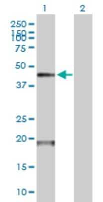 Western Blot: Airway Trypsin-like Protease/HAT/TMPRSS11D Antibody [H00009407-B01P] - Analysis of TMPRSS11D expression in transfected 293T cell line by TMPRSS11D polyclonal antibody.  Lane 1: TMPRSS11D transfected lysate(45.98 KDa). Lane 2: Non-transfected lysate.