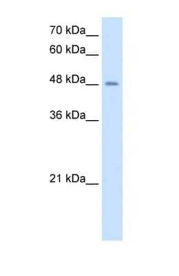 Western Blot: Airway Trypsin-like Protease/HAT/TMPRSS11D Antibody [NBP1-62545] - HepG2 cell lysate, concentration 2.5 ug/ml.