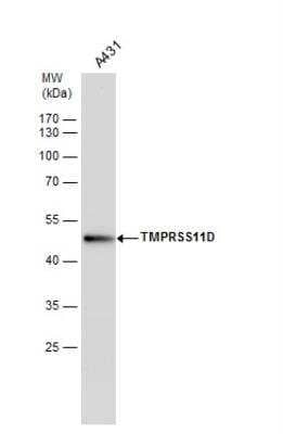 Western Blot: Airway Trypsin-like Protease/HAT/TMPRSS11D Antibody [NBP2-20668] - Whole cell extracts (30 ug) was separated by 10% SDS-PAGE, and the membrane was blotted with TMPRSS11D antibody diluted by 1:500.