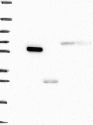 Western Blot: Airway Trypsin-like Protease/HAT/TMPRSS11D Antibody [NBP3-17648] - Lane 1: Marker [kDa] 250, 130, 95, 72, 55, 36, 28, 17, 10;   Lane 2: RT4;   Lane 3: U-251 MG;   Lane 4: Human Plasma;   Lane 5: Liver;   Lane 6: Tonsil