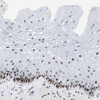 Immunohistochemistry-Paraffin Ajuba Antibody