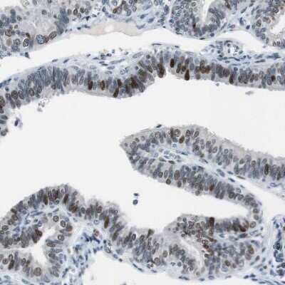 Immunohistochemistry-Paraffin Ajuba Antibody