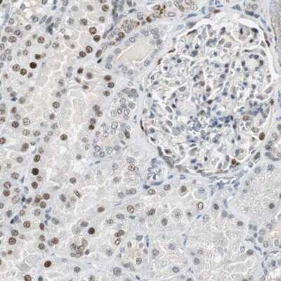 Immunohistochemistry-Paraffin Ajuba Antibody