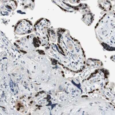 Immunohistochemistry-Paraffin: Ajuba Antibody [NBP1-89570] - Staining of human placenta shows strong nuclear positivity in trophoblastic cells.