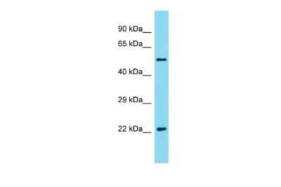 Western Blot: Akirin2 Antibody [NBP3-10695] - Western blot analysis of Akirin2 in Mouse Spleen lysates. Antibody dilution at 1.0ug/ml