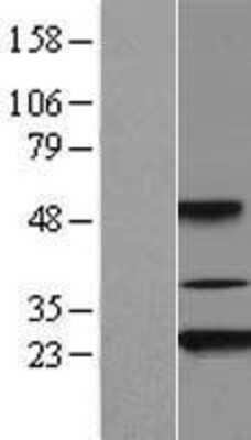 Western Blot: Akirin2 Overexpression Lysate (Adult Normal) [NBL1-07431] Left-Empty vector transfected control cell lysate (HEK293 cell lysate); Right -Over-expression Lysate for Akirin2.