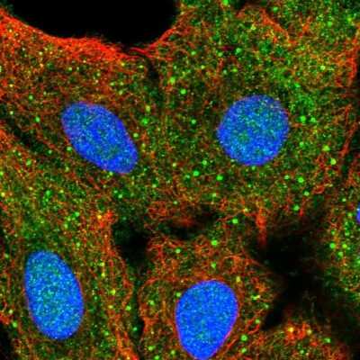 Immunocytochemistry/Immunofluorescence: Akt2 Antibody [NBP2-55812] - Staining of human cell line A549 shows localization to nucleus, cytosol & vesicles.