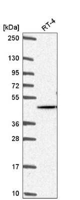 Western Blot: Akt2 Antibody [NBP2-55812] - Western blot analysis in human cell line RT-4.