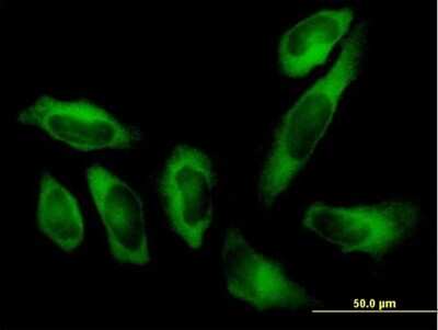 Immunocytochemistry/Immunofluorescence: Alanyl tRNA synthetase Antibody [H00000016-B01P] - Analysis of purified antibody to AARS on HeLa cell. (antibody concentration 10 ug/ml)