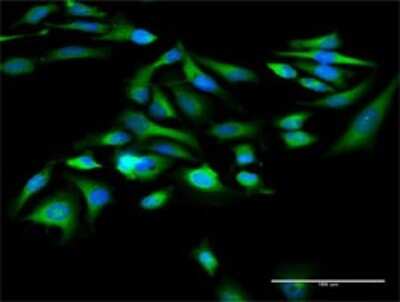 Immunocytochemistry/Immunofluorescence: Alanyl tRNA synthetase Antibody [H00000016-D01P] - Analysis of antibody to AARS on HeLa cell. Antibody concentration 20 ug/ml.