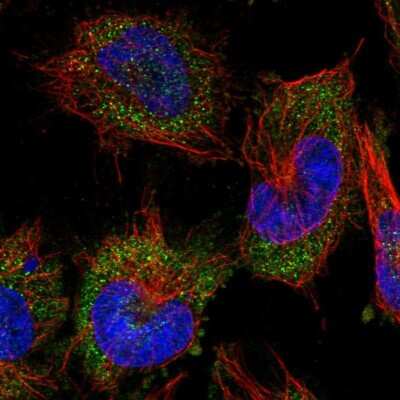 <b>Independent Antibodies Validation. </b>Immunocytochemistry/Immunofluorescence: Alanyl tRNA synthetase Antibody [NBP2-58166] - Staining of human cell line U-251 MG shows localization to cytosol.