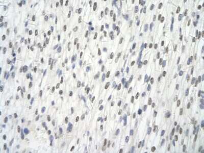 Immunohistochemistry: Alanyl tRNA synthetase Antibody [NBP1-57136] - Paraffin Embedded Tissue: Human Heart cell Cellular Data: cardiac cell of renal tubule Antibody Concentration: 4.0 - 8.0 ug/ml Magnification: 400X