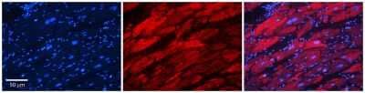 Immunohistochemistry: Alanyl tRNA synthetase Antibody [NBP1-57136] - Formalin Fixed Paraffin Embedded Tissue: Human Adult heart Observed Staining: Cytoplasmic Primary Antibody Concentration: 1:600 Secondary Antibody: Donkey anti-Rabbit-Cy2/3 Secondary Antibody Concentration: 1:200 Magnification: 20X Exposure Time: 0.5 - 2.0 sec Protocol located in Reviews and Data.