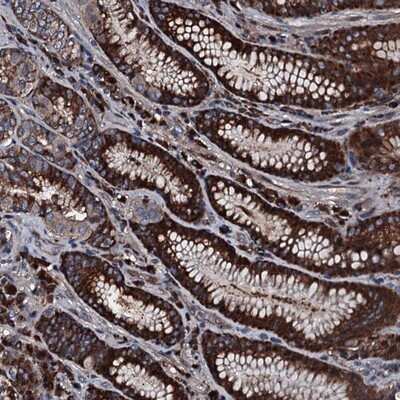 Immunohistochemistry-Paraffin: Alanyl tRNA synthetase Antibody [NBP1-87414] - Staining of human stomach shows strong cytoplasmic positivity in glandular cells.