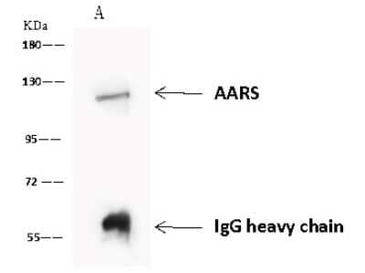 Immunoprecipitation: Alanyl tRNA synthetase Antibody [NBP2-97723] - Alanyl tRNA synthetase was immunoprecipitated using: Lane A: 0.5 mg U-251 MG Whole Cell Lysate. 4 ul anti-Alanyl tRNA synthetase rabbit polyclonal antibody and 60 ug of Immunomagnetic beads. Protein A/G. Primary antibody: Anti-Alanyl tRNA synthetase rabbit polyclonal antibody, at 1:100 dilution. Secondary antibody: Goat Anti-Rabbit IgG (H+L)/HRP at 1/10000 dilution. Developed using the ECL technique. Performed under reducing conditions. Predicted band size: 107 kDa. Observed band size: 107 kDa