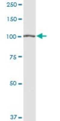 Western Blot: Alanyl tRNA synthetase Antibody [H00000016-D01P] - Analysis of AARS expression in human kidney.