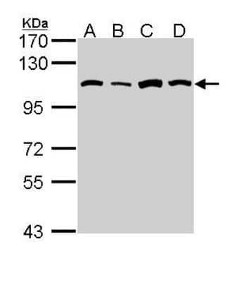 Western Blot: Alanyl tRNA synthetase Antibody [NBP1-31706] - (30 ug of whole cell lysate)  A: A431  B: H1299  C: Hela  D: Hep G2  7.5% SDS PAGE diluted at 1:1000