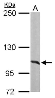 Western Blot: Alanyl tRNA synthetase Antibody [NBP1-31706] - Sample (50 ug of whole cell lysate) A: Mouse liver 5% SDS PAGE; antibody diluted at 1:1000.