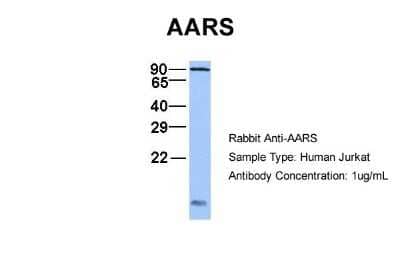 Western Blot: Alanyl tRNA synthetase Antibody [NBP1-57136] - Sample Type: Jurkat Antibody Dilution: 1.0 ug/ml AARS is supported by BioGPS gene expression data to be expressed in Jurkat