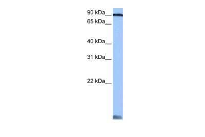 Western Blot: Alanyl tRNA synthetase Antibody [NBP1-57136] - Reccomended Titration: 0.2 - 1 ug/ml Positive Control: Jurkat cell lysate AARS is supported by BioGPS gene expression data to be expressed in Jurkat