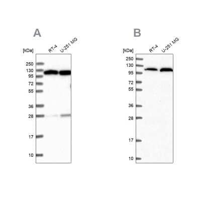 Western Blot: Alanyl tRNA synthetase Antibody [NBP1-87414] - Analysis using Anti-AARS antibody NBP1-87414 (A) shows similar pattern to independent antibody NBP2-58166 (B).