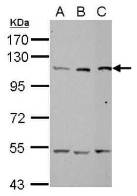 Western Blot: Alanyl tRNA synthetase Antibody [NBP2-15332] - Sample (30 ug of whole cell lysate) A: 293T B: A431 C: HepG2 7. 5% SDS PAGE; antibody diluted at 1:1000.