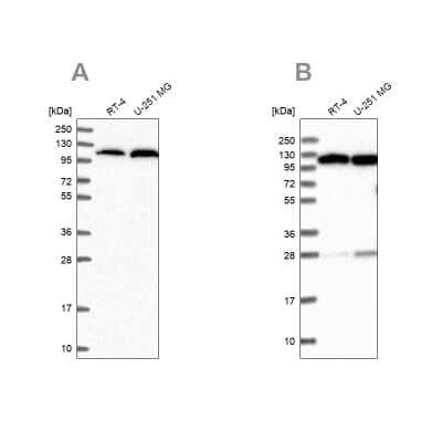 Western Blot: Alanyl tRNA synthetase Antibody [NBP2-58166] - Analysis using Anti-AARS antibody NBP2-58166 (A) shows similar pattern to independent antibody NBP1-87414 (B).