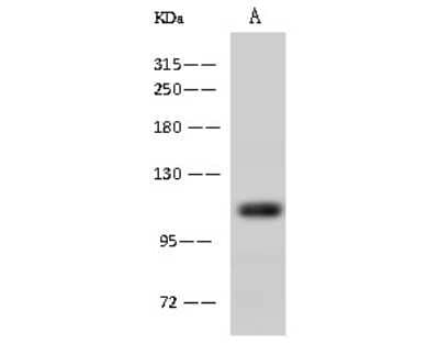 Western Blot: Alanyl tRNA synthetase Antibody [NBP2-97723] - Anti-Alanyl tRNA synthetase rabbit polyclonal antibody at 1:500 dilution. Lane A: K562 Whole Cell Lysate. Lysates/proteins at 30 ug per lane. Secondary Goat Anti-Rabbit IgG (H+L)/HRP at 1/10000 dilution. Developed using the ECL technique. Performed under reducing conditions. Predicted band size: 107 kDa. Observed band size: 107 kDa