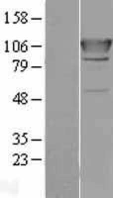 Western Blot: Alanyl tRNA synthetase Overexpression Lysate (Adult Normal) [NBL1-07165] Left-Empty vector transfected control cell lysate (HEK293 cell lysate); Right -Over-expression Lysate for Alanyl tRNA synthetase.