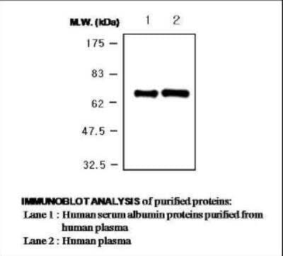 Western Blot: Albumin Antibody (1G2) [NBP2-11514]
