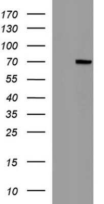 Western Blot: Albumin Antibody (OTI3B10) - Azide and BSA Free [NBP2-70149] - Analysis of HEK293T cells were transfected with the pCMV6-ENTRY control (Left lane) or pCMV6-ENTRY Albumin.