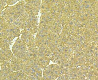 Immunohistochemistry: Aldehyde Dehydrogenase 1-A1/ALDH1A1 Antibody (8F1) [NBP2-76908] - Immunohistochemical analysis of paraffin-embedded human liver tissue using anti-ALDH1A1 antibody. Counter stained with hematoxylin.