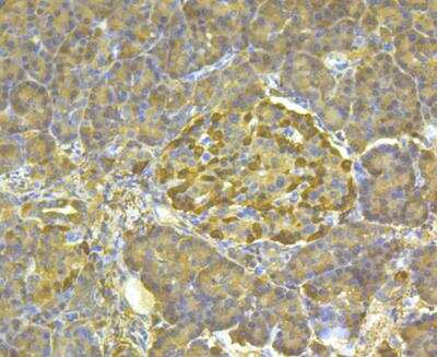 Immunohistochemistry: Aldehyde Dehydrogenase 1-A1/ALDH1A1 Antibody (8F1) [NBP2-76908] - Immunohistochemical analysis of paraffin-embedded human pancreas tissue using anti-ALDH1A1 antibody. Counter stained with hematoxylin.