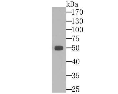 Western Blot: Aldehyde Dehydrogenase 1-A1/ALDH1A1 Antibody (8F1) [NBP2-76908] - Western blot analysis of ALDH1A1 on human liver tissue lysate using anti-ALDH1A1 antibody at 1/10,000 dilution.