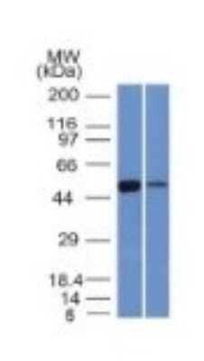 Western Blot: Aldehyde Dehydrogenase 1-A1/ALDH1A1 Antibody (ALDH1A1/1381) - Azide and BSA Free [NBP2-54422] - K562 and Lung Lysate using ALDH1A1 Monoclonal Antibody (ALDH1A1/1381).